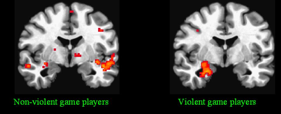Brain-of-Violent-Game-Players